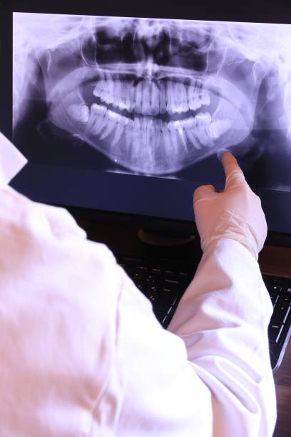 Best Emergency Tooth Extraction in Scottsville, KY